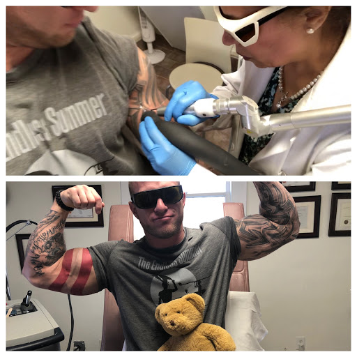 Explore phoenix tattoo ideas male, creative tattoo ideas in Raleigh, available at ExcelLase