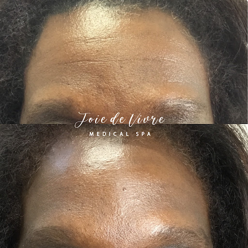 Explore arsenal tattoo ideas, creative tattoo ideas in Canton, available at JDV Med Spa