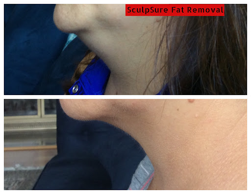 Explore face tattoos above eyebrow tattoo ideas, creative tattoo ideas in Lake Oswego, available at Lake Oswego Vein and Aesthetic LOVA