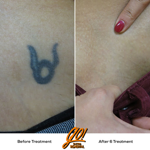 Explore ironman triathlon tattoo ideas, creative tattoo ideas in Allentown, available at Removery Tattoo Removal & Fading