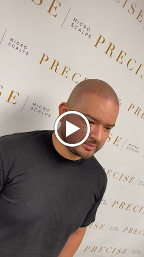 Precise Scalp Micro - Scalp Micropigmentation Service and Training image