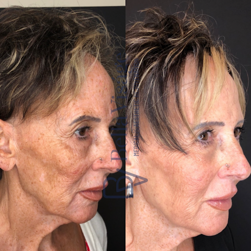 Explore tattoo ideas black people, creative tattoo ideas in Lakeland, available at Bella Visge Medical & Aesthetic Rejuvenation