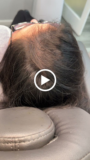 Explore feminine arm tattoo ideas, creative tattoo ideas in Roseville, available at NuHair Ink. Scalp MicroPigmentation & Aesthetic Clinic of Sacramento