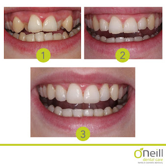 O'Neill Dental Care - O'Neill Dental Care