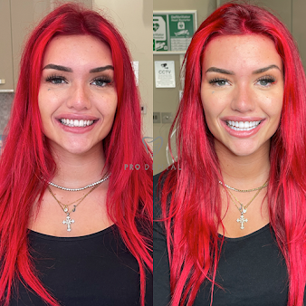 برو الأسنان - Pro Dental