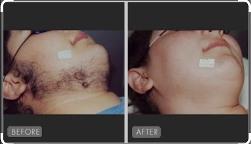 Explore shield maiden tattoo ideas, creative tattoo ideas in Tempe, available at Sparkle Laser HairTattoo Removal