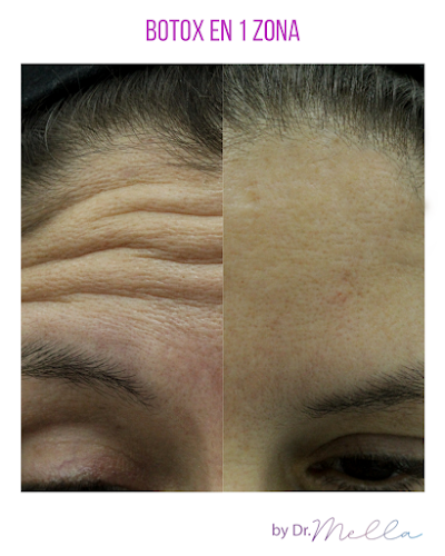 Teléfono de Medicina Estética Integral MD