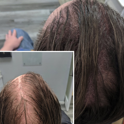 Explore believe tattoo ideas, creative tattoo ideas in Roseville, available at NuHair Ink. Scalp MicroPigmentation & Aesthetic Clinic of Sacramento