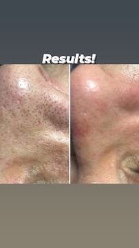 Contoured Beauty Esthetics - Photo 4 - Car repair in Waco, TX, Waco