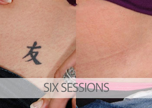 Explore vertical tattoo ideas, creative tattoo ideas in Palm Harbor, available at EradiTatt Tattoo Removal of Palm HarborClearwater