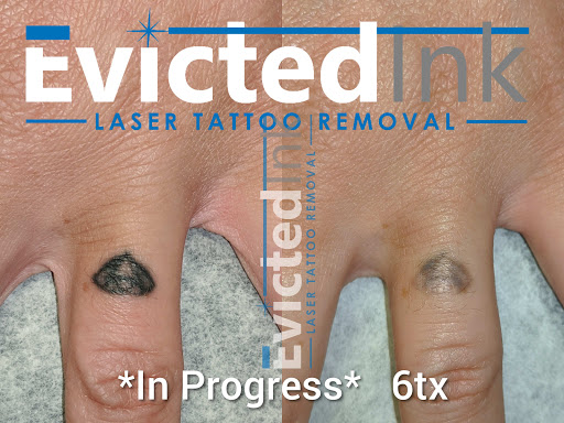 Explore wolf tattoo ideas for guys, creative tattoo ideas in Wichita, available at Evicted Ink Laser Tattoo Removal