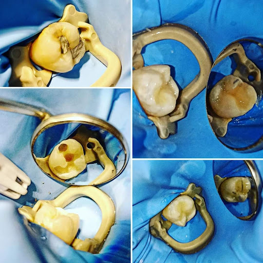 Consultorio de Especialidades dentales EndoDent