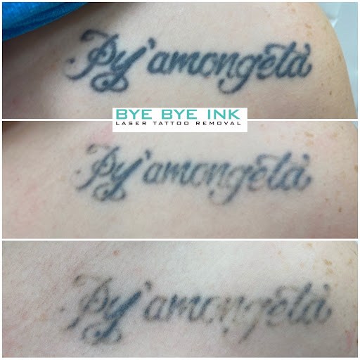 Explore paint tattoo ideas, creative tattoo ideas in Middle Village, available at Bye Bye Ink Laser Tattoo Removal