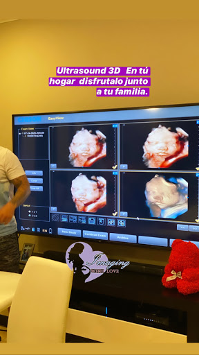 Imaging With Love Mobile 3D/4D/ 5D Pregnancy 🤰 Ultrasound