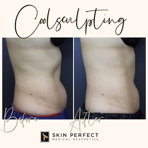 Explore outer thigh tattoo ideas, creative tattoo ideas in Whittier, available at Skin Perfect Medical Aesthetics