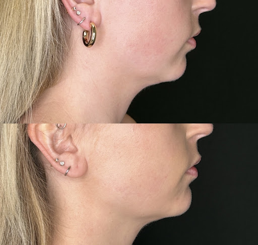 Explore meaning tattoo tattoo ideas for women, creative tattoo ideas in Chesapeake, available at Dermacare of Hampton Roads