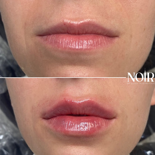 Noir Medical Aesthetics image