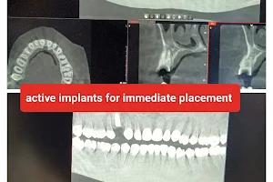 𝗗𝗿 𝗡𝗶𝗽𝘂𝗻'𝘀 𝗔𝗹𝗽𝗵𝗮 𝗗𝗲𝗻𝘁𝗮𝗹 𝗮𝗻𝗱 𝗜𝗺𝗽𝗹𝗮𝗻𝘁 𝗖𝗲𝗻𝘁𝗿𝗲 - Dental Clinic/RCT/OPG/CBCT/Braces/Implant Denture/Dentist in Barnala image
