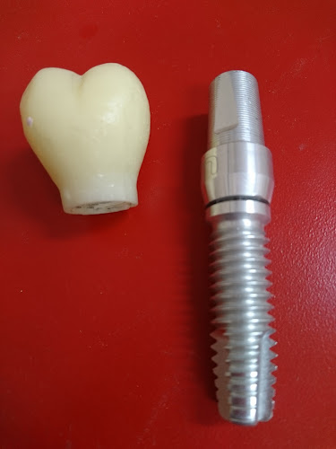 Opiniones de Implants Manta en Manta - Dentista