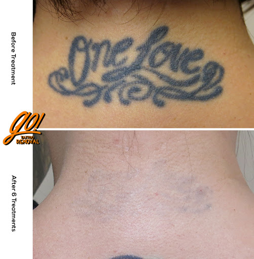 Explore cool stick and poke tattoo ideas, creative tattoo ideas in Allentown, available at Removery Tattoo Removal & Fading