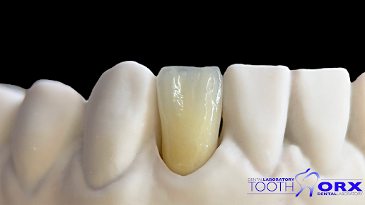 الأسنان Worx - Tooth Worx