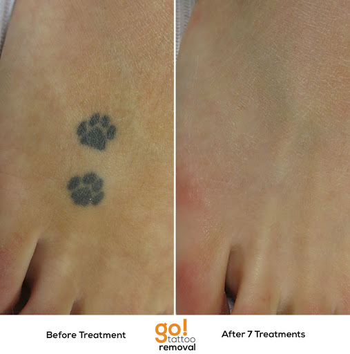 Explore horoscope tattoo ideas, creative tattoo ideas in Allentown, available at Removery Tattoo Removal & Fading