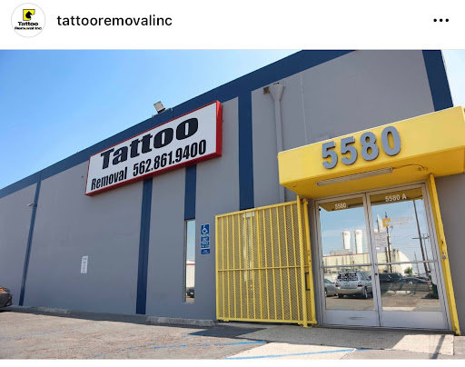 Explore forest tattoo ideas, creative tattoo ideas in South Gate, available at Tattoo Removal Inc