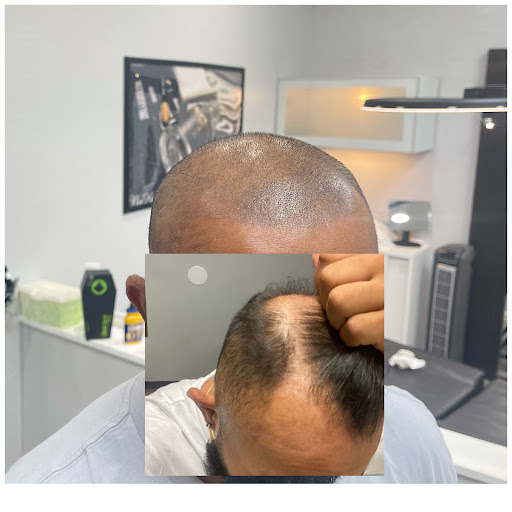 Explore machinist tattoo ideas, creative tattoo ideas in Roseville, available at NuHair Ink. Scalp MicroPigmentation & Aesthetic Clinic of Sacramento