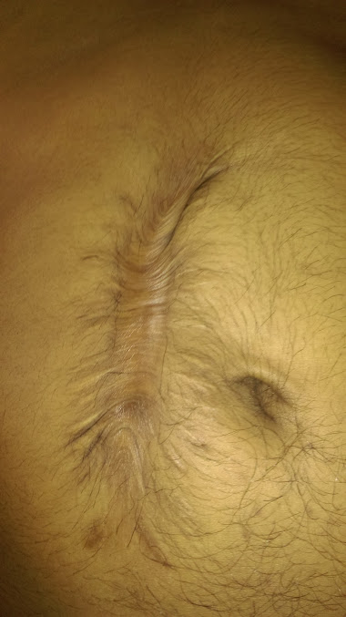 Apollo Cosmetic Surgical Center Pvt. Ltd. - Apollo Cosmetic Surgical Center Pvt. Ltd.