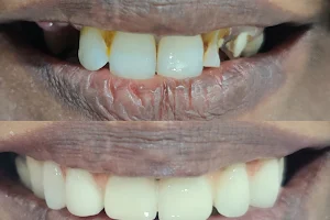 Endosmile Dentistry image