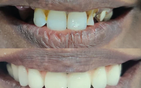 Endosmile Dentistry image