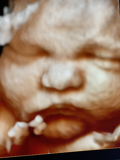 Hide & Seek Prenatal Peek 3D 4D HD Elective Ultrasound