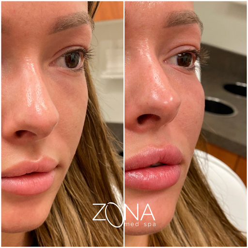 Skin Care Clinic «ZONA MED SPA», reviews and photos, 9767 N 91st St #102, Scottsdale, AZ 85258, USA