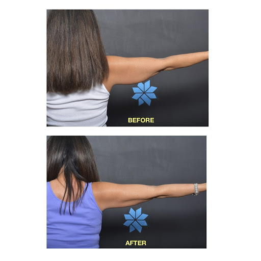 Explore back of knee tattoo ideas, creative tattoo ideas in Chino, available at SoCal Body Institute