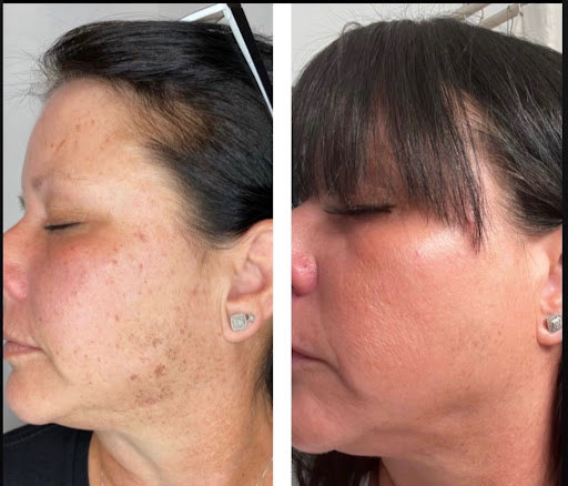 Explore small christian tattoo ideas, creative tattoo ideas in Tucson, available at Allure Medical