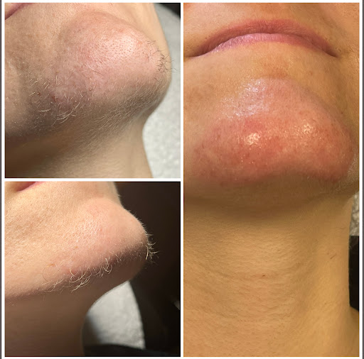 Explore scoliosis tattoo ideas, creative tattoo ideas in Des Moines, available at Bare Beaute Permanent Hair Removal By Electrolysis, LLC