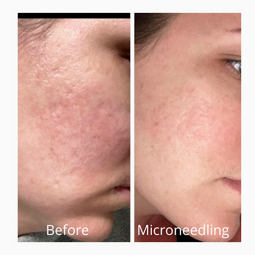 Explore patchwork tattoos ideas, creative tattoo ideas in Johnston, available at Brows & Body