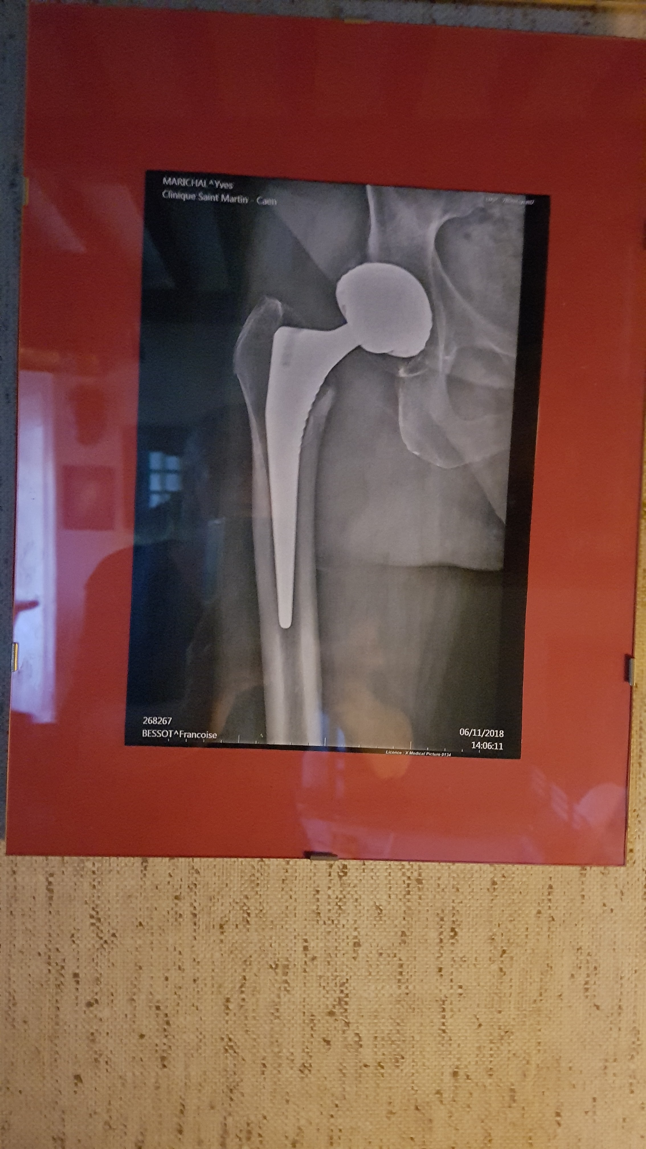 Photo n° 1 de l'avis de Francoise.e fait le 21/10/2018 à 18:26