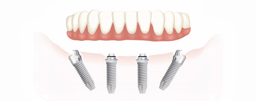 Dentaris Clínica Dental