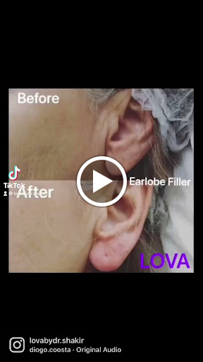 Explore w.a.y.s tattoo ideas, creative tattoo ideas in Lake Oswego, available at Lake Oswego Vein and Aesthetic LOVA