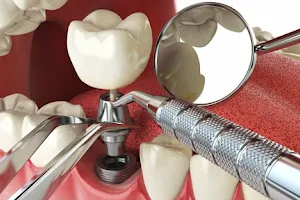 Akshar Dental Care &Implant centre-Dr.Ajay Chandana (MDS) image