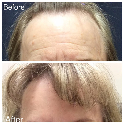 Explore temple tattoo ideas, creative tattoo ideas in Lake Oswego, available at Lake Oswego Vein and Aesthetic LOVA