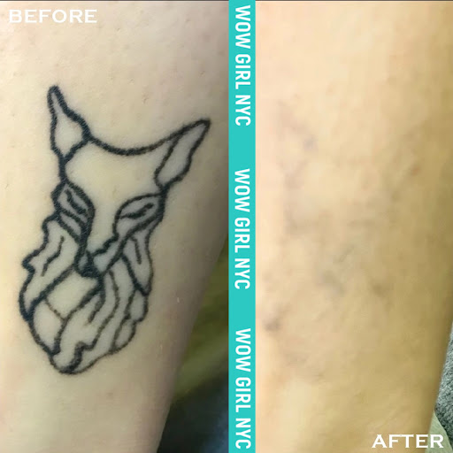 Find cat tattoo ideas small for your next unique tattoo in New York at WOW LASER NYC Tattoo removal in New York