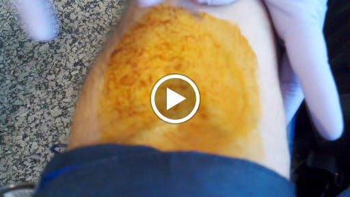 Blood Donation Center «American Red Cross», reviews and photos