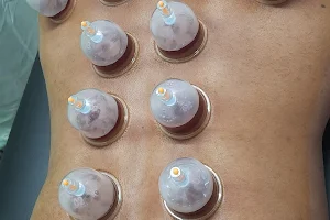 SKM Physiotherapy & Rehabilitation center [ Cupping & Hijama therapy center ] image