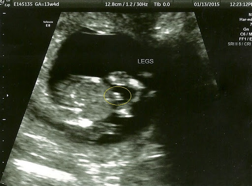 Hello Baby - Pregnancy Scan