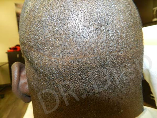 Medical Hair Transplant & Aesthetics image