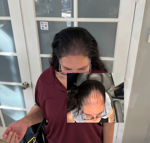 Find simple sun tattoo ideas for your next unique tattoo in Roseville at NuHair Ink. Scalp MicroPigmentation & Aesthetic Clinic of Sacramento