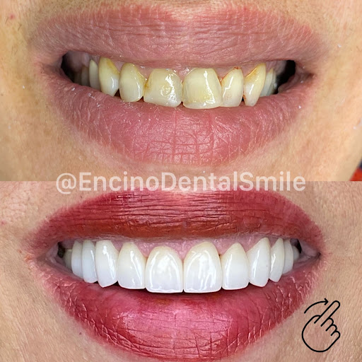 Encino Dental Smile image