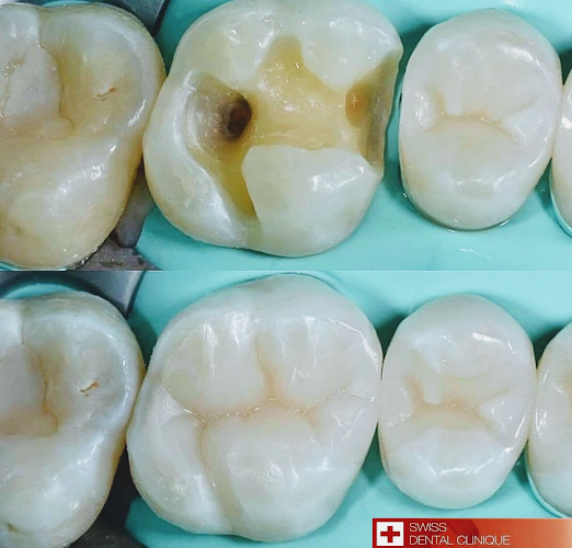 Clinica Swiss Dental - <nil>